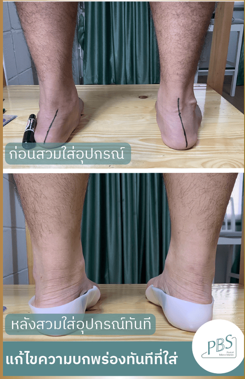 No. 8 - แผ่นรองเท้าแบนเพื่อสุขภาพ - 4